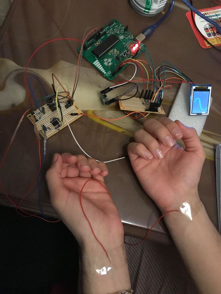 poza_ecg.jpg