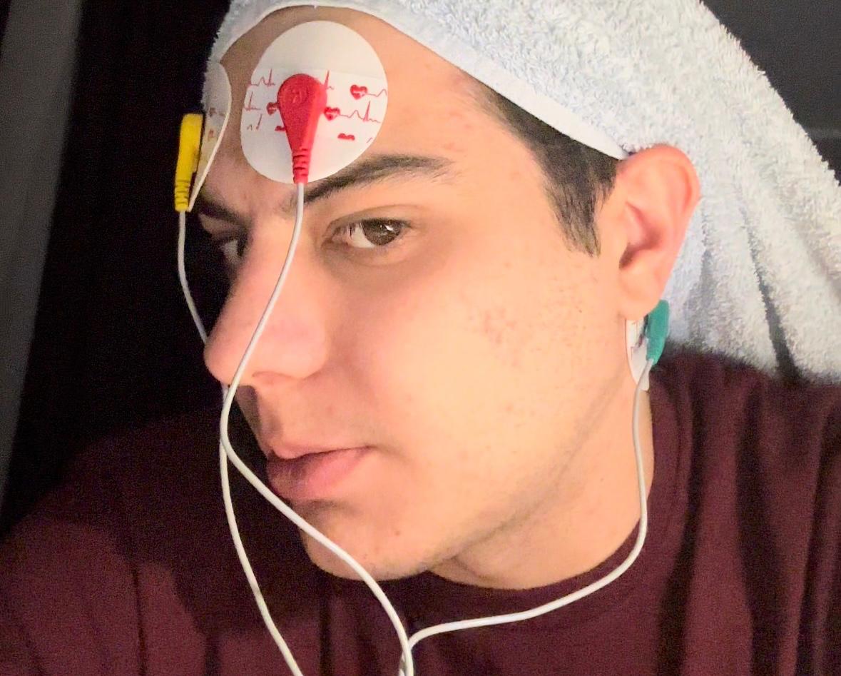victor.mandescu_electrozi_deschisi.jpg