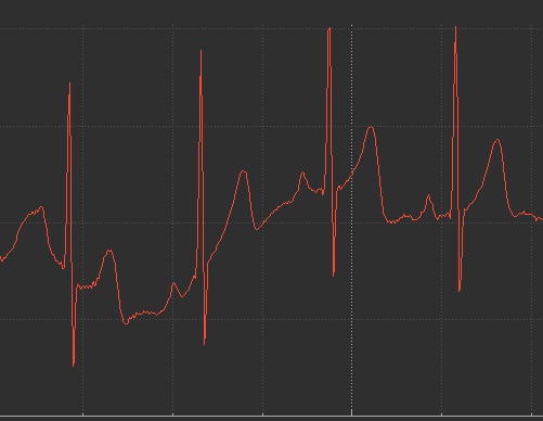 razvan.rotaru1601-ecg_output.jpg